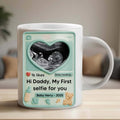 Mug - 11oz - White 2